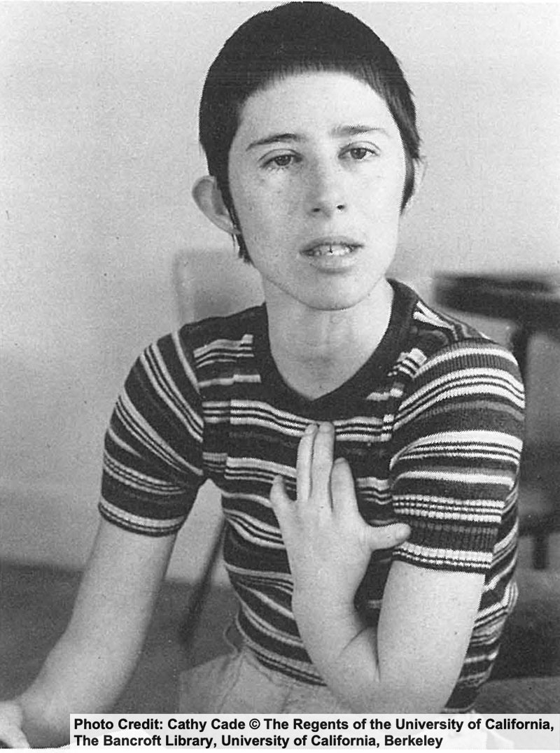 Woman seated with short hair. Her left arm is shortened. Photo credit: Cathy Cade
